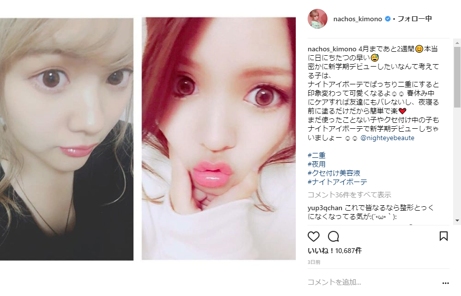 ナイトアイボーテ,有名人.有名